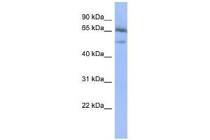 NFKBIE antibody used at 0. (NFKBIE 抗体  (Middle Region))
