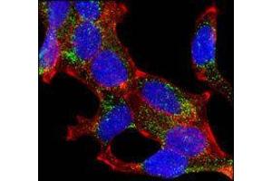 Confocal immunofluorescence analysis of LNCaP cells using AMACR mouse mAb (green). (AMACR 抗体)