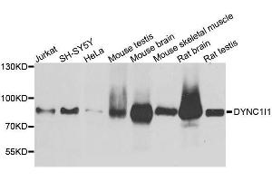 Western blot analysis of extracts of various cell lines, using DYNC1I1 antibody. (DYNC1I1 抗体  (AA 1-220))