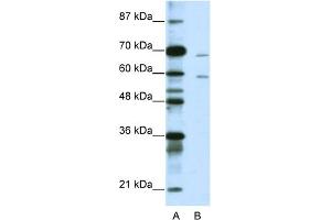 WB Suggested Anti-FOXA2 Antibody Titration:  1. (FOXA2 抗体  (N-Term))