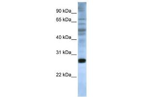EIF4E antibody used at 1 ug/ml to detect target protein. (EIF4E 抗体  (C-Term))