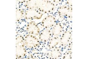 Immunohistochemistry of paraffin embedded rat kidney using NPEPL1 (ABIN7073185) at dilution of 1:100 (400x lens) (BIVM 抗体)