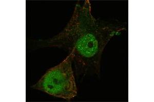 Confocal immunofluorescence analysis of PANC-1 cells using FOXP3 mouse mAb (green). (FOXP3 抗体)