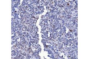 IHC analysis of Lamin A+C/LMNA using anti-Lamin A+C/LMNA antibody (ABIN7601843). (Lamin A/C 抗体  (AA 481-646))