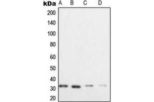 Western blot analysis of XRCC2 expression in HeLa (A), Raji (B), SW480 (C), Caco2 (D) whole cell lysates. (XRCC2 抗体  (C-Term))