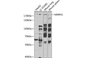 Western blot analysis of extracts of various cell lines, using MMRN1 Antibody (ABIN6129053, ABIN6143926, ABIN6143927 and ABIN6222357) at 1:1000 dilution. (Multimerin 1 抗体  (AA 949-1228))