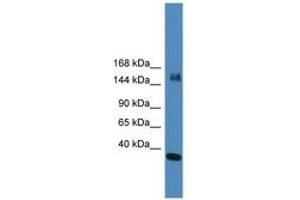 Image no. 1 for anti-Lysine (K)-Specific Demethylase 6A (KDM6A) (N-Term) antibody (ABIN6745346) (KDM6A 抗体  (N-Term))