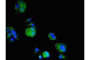 Immunofluorescent analysis of MCF-7 cells using ABIN7151778 at dilution of 1:100 and Alexa Fluor 488-congugated AffiniPure Goat Anti-Rabbit IgG(H+L) (ELMO3 抗体  (AA 464-596))