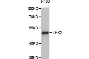 Western blot analysis of extracts of H460 cells, using LHX2 antibody (ABIN5998134) at 1/1000 dilution. (LHX2 抗体)