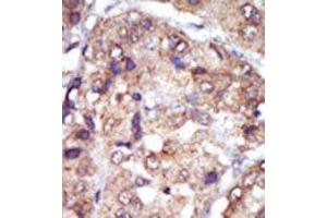 Image no. 2 for anti-V-Yes-1 Yamaguchi Sarcoma Viral Related Oncogene Homolog (LYN) (N-Term) antibody (ABIN359987) (LYN 抗体  (N-Term))