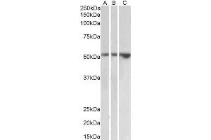 ABIN2613489 (2µg/ml) staining of Kidney (A), Testis (B) and Uterus (C) lysates (35µg protein in RIPA buffer).