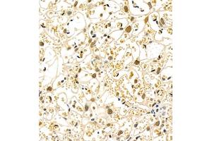 Immunohistochemistry of paraffin embedded mouse placenta using Skar (ABIN7074970) at dilution of 1:900 (400x lens) (p46 抗体)
