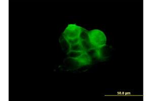 Immunofluorescence of monoclonal antibody to RDX on A-431 cell. (Radixin 抗体  (AA 1-583))