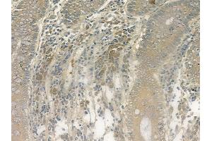 ABIN6264244 and ABIN6269328 at 1/100 staining human normal colon tissue by IHC-P. (PKC delta 抗体  (C-Term))