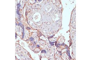 Immunohistochemistry (IHC) image for anti-ADP-Ribosylation Factor-Like 4D (ARL4D) (AA 92-201) antibody (ABIN7265495)