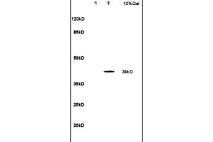 SDS-PAGE (SDS) image for anti-Leukotriene B4 Receptor (LTB4R) (AA 101-200) antibody (ABIN748628)