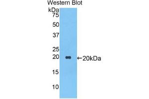Western blot analysis of the recombinant protein. (SERPINA1 抗体  (AA 27-181))