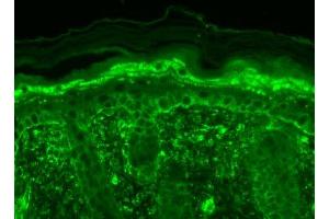 Immunohistochemistry (IHC) image for anti-Transient Receptor Potential Cation Channel, Subfamily V, Member 3 (TRPV3) (AA 458-474) antibody (Atto 594) (ABIN2485235)
