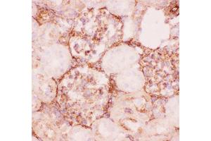Anti-P Glycoprotein Picoband antibody,  IHC(F): Rat Kidney Tissue (ABCB1 抗体  (Middle Region))