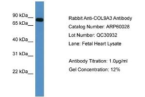 WB Suggested Anti-COL9A3  Antibody Titration: 0. (COL9A3 抗体  (C-Term))