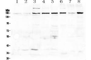 Western blot analysis of EEA1 using anti-EEA1 antibody . (EEA1 抗体)