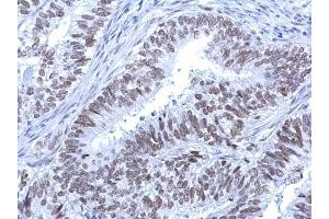 Immunohistochemistry (IHC) image for anti-helicase 2, X-linked (ATRX) (C-Term) antibody (ABIN2855005)