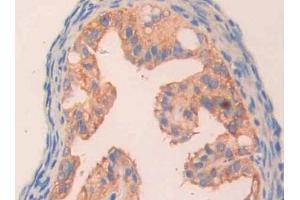 Immunohistochemistry (IHC) image for anti-Carbonic Anhydrase VB, Mitochondrial (CA5B) (AA 63-225) antibody (ABIN7437326)