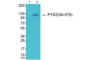 Western blot analysis of extracts from 3T3 cells (Lane 2), using PYK2 (Ab-579) antiobdy. (PTK2B 抗体  (Tyr579))