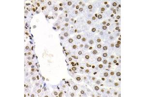 Immunohistochemistry of paraffin-embedded rat liver using NFKB2 antibody at dilution of 1:200 (400x lens). (NFKB2 抗体)