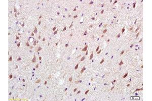 Formalin-fixed and paraffin embedded: rat brain tissue labeled with Anti-MAG-a/L-MAG Polyclonal Antibody , Unconjugated at 1:200, followed by conjugation to the secondary antibody and DAB staining (MAG 抗体  (AA 551-626))