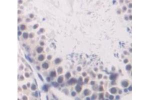 IHC-P analysis of Human Tissue, with DAB staining. (ube3a 抗体  (AA 158-407))