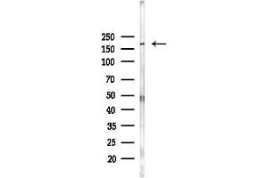 Western blot analysis of lysates from Hela cells(heat-shock,45 min treatment), using Phospho-Rictor (Thr1135) Antibody at 1/1000 dilution.