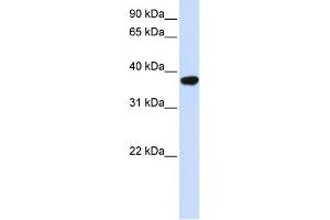 WB Suggested Anti-ICMT Antibody Titration:  0. (ICMT 抗体  (Middle Region))