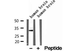 Western blot analysis of extracts of human brain tissue, using CAPZA1 antibody. (CAPZA1 抗体  (Internal Region))