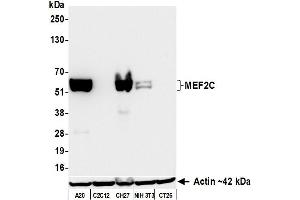 Western Blotting (WB) image for anti-Myocyte Enhancer Factor 2C (MEF2C) (AA 425-475) antibody (ABIN7795747) (Recombinant MEF2C 抗体  (AA 425-475))