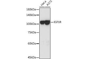 Western blot analysis of extracts of various cell lines, using IGF1R antibody (ABIN3020767, ABIN3020768, ABIN3020769 and ABIN6213714) at 1:3000 dilution. (IGF1R 抗体  (AA 660-760))