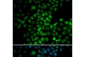 Immunofluorescence analysis of HeLa cells using C11orf30 Polyclonal Antibody (EMSY 抗体)