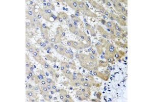 Immunohistochemistry of paraffin-embedded human liver injury using RBP2 antibody at dilution of 1:100 (x40 lens). (RBP2 抗体)