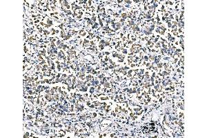IHC analysis of ATG16L1 using anti-ATG16L1 antibody (ABIN7602244).