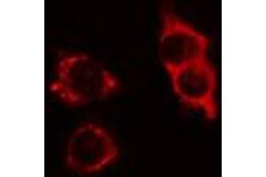 ABIN6274412 staining LOVO cells by IF/ICC. (ATPBD3 抗体  (C-Term))