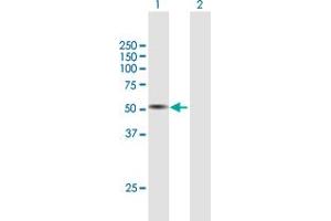 Western Blot analysis of TPH1 expression in transfected 293T cell line by TPH1 MaxPab polyclonal antibody. (Tryptophan Hydroxylase 1 抗体  (AA 1-444))