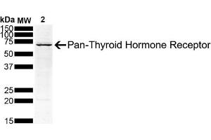 Western Blot analysis of Human Hep G2 Hepatoblastoma Cell lysate showing detection of Thyroid Hormone Receptor protein using Mouse Anti-Thyroid Hormone Receptor Monoclonal Antibody, Clone H43 (ABIN6952041). (THRA 抗体)