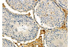 ABIN6257643 and ABIN6274758 at 1/100 staining Mouse testis tissue by IHC-P. (RPS5 抗体  (Internal Region))