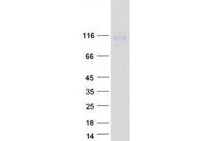 Western Blotting (WB) image for Interleukin 31 Receptor A (IL31RA) protein (Myc-DYKDDDDK Tag) (ABIN2723408)