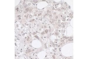 Immunohistochemistry (IHC) image for anti-Adhesion Regulating Molecule 1 (Adrm1) (AA 357-407) antibody (ABIN7449390) (ADRM1 抗体  (AA 357-407))