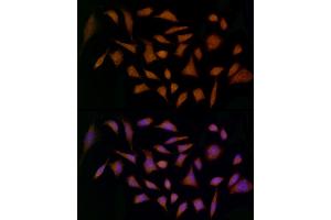 Immunofluorescence analysis of HeLa cells using MDK Rabbit pAb (ABIN3020790, ABIN3020791, ABIN3020792 and ABIN6213725) at dilution of 1:25 (40x lens).