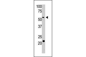 The BACE2 polyclonal antibody  is used in Western blot to detect BACE2 in HL-60 cell lysate. (BACE2 抗体  (Internal Region))