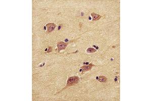 Immunohistochemistry (Paraffin-embedded Sections) (IHC (p)) image for anti-Ubiquitin Carboxyl-terminal Esterase L1 (Ubiquitin Thiolesterase) (UCHL1) (AA 187-216), (C-Term) antibody (ABIN1882188)
