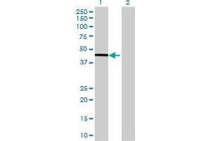 Western Blot analysis of ALKBH1 expression in transfected 293T cell line by ALKBH1 MaxPab polyclonal antibody. (ALKBH1 抗体  (AA 1-389))