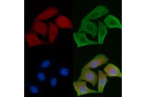 ABIN6264151 and ABIN6279649 staining Hela cells by IF/ICC.